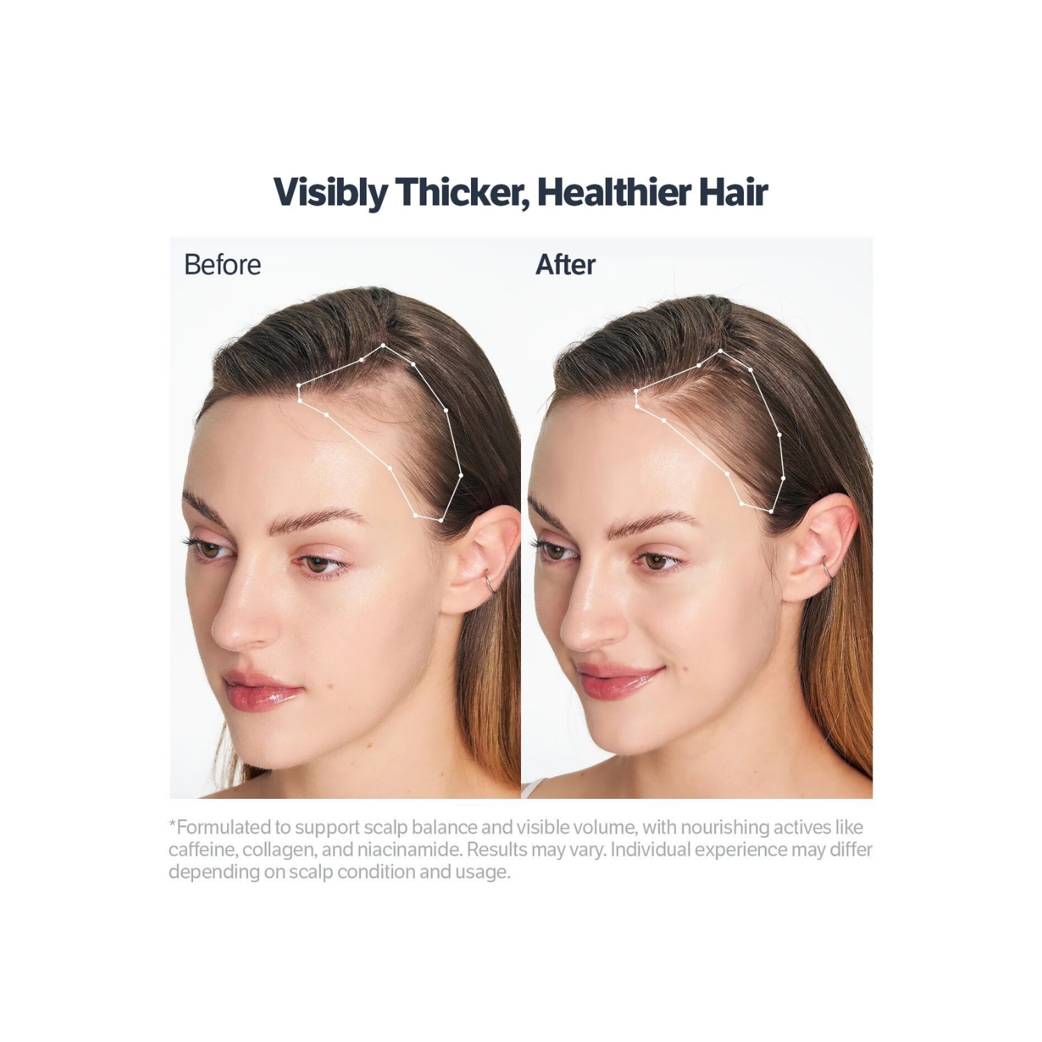 Sungboon Editor Deep Collagen Retinol Power Boosting Scalp Serum 15ml - Shop K-Beauty in Australia