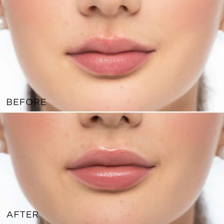 ARTDECO Glossy Lip Volumizer - Shop K-Beauty in Australia
