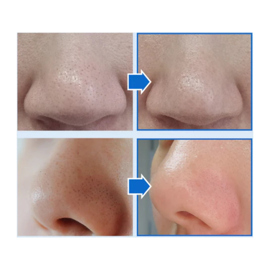 Extra Super 9 Plus Blackhead Out Nose Pack