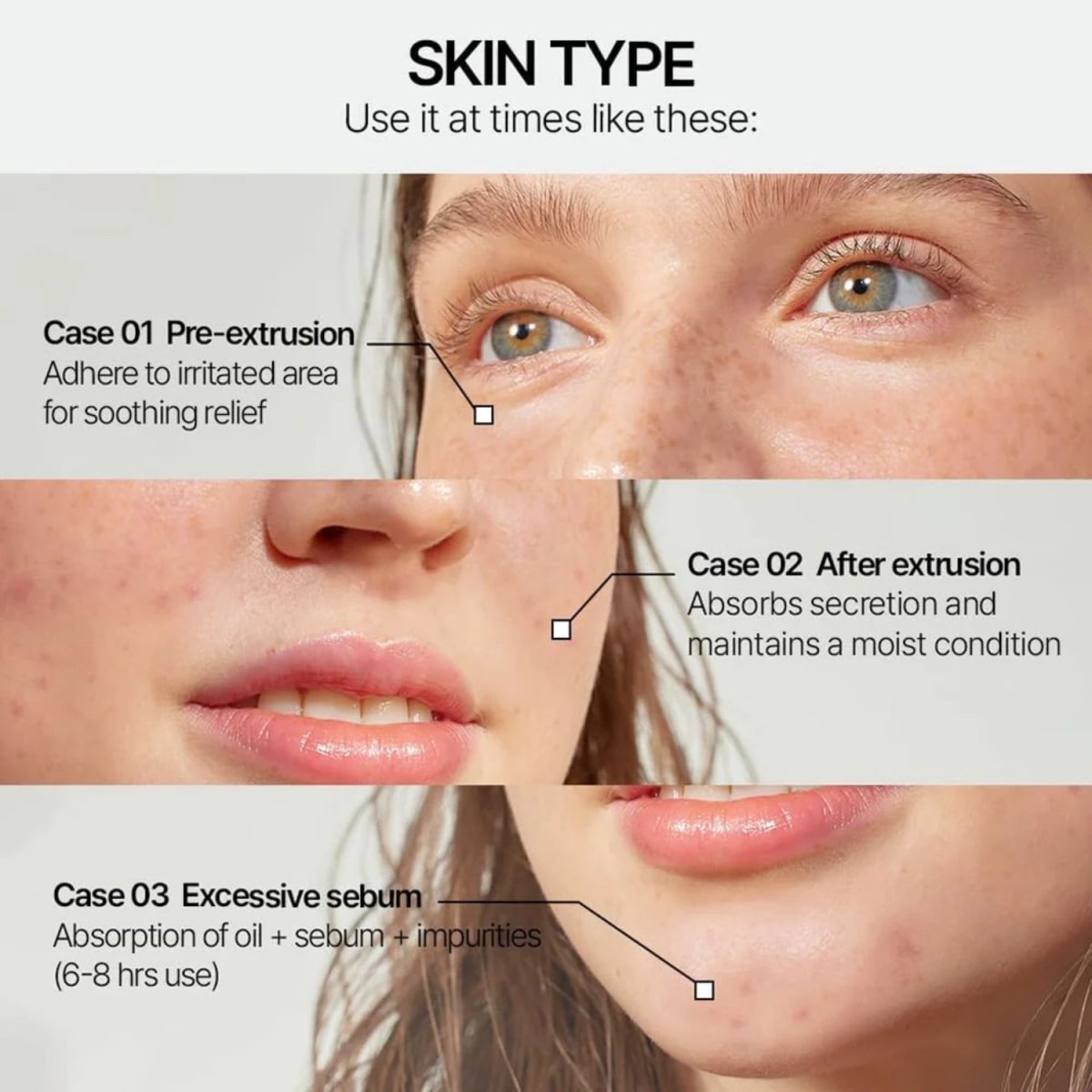Parnell Cicamanu Clear Patch 68ea | La Cosmetique