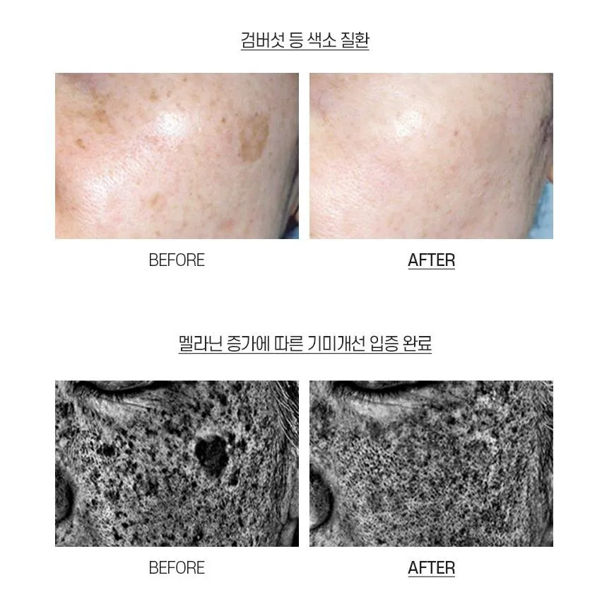 MEDI-PEEL Melanon X Cream 30ml  - La Cosmetique