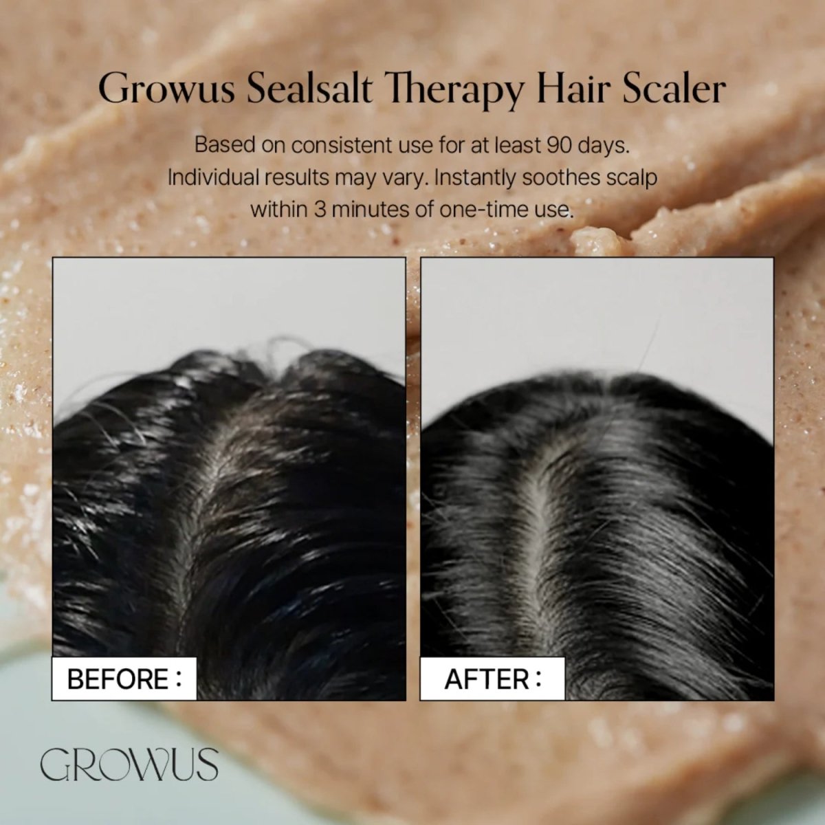 Growus Sea Salt Therapy Scalp Scaler 120g | La Cosmetique