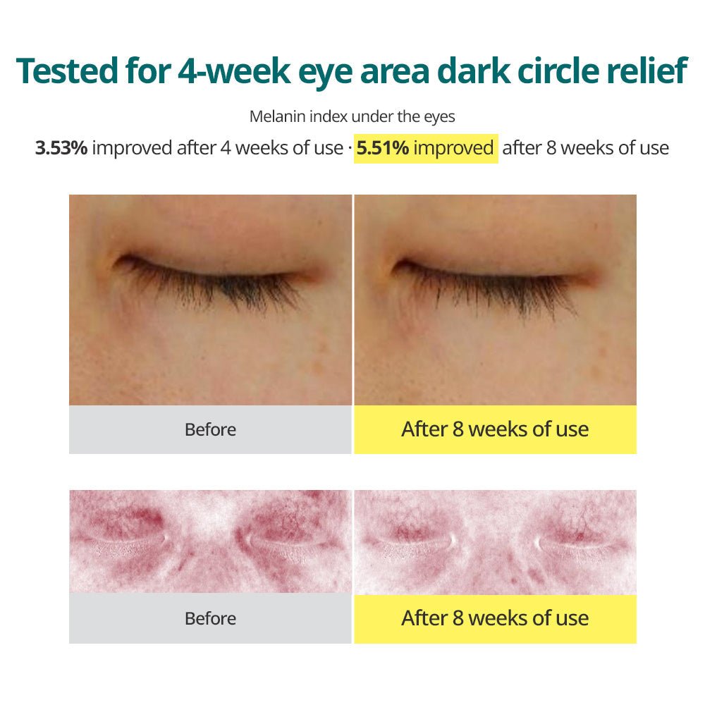 Goodal Green Tangerine Vita C Dark Circle Eye Cream [Renewal] 30ml | La Cosmetique
