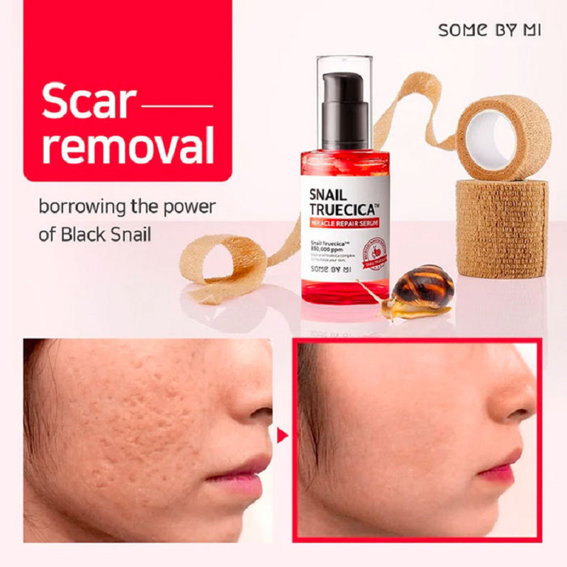 Some By Mi Snail Truecica Miracle Repair Serum 50ml bottle shown, featuring a sleek design and clear labeling.