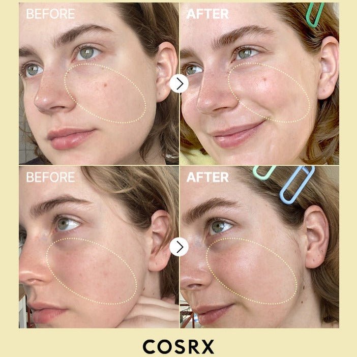 COSRX The Vitamin C 23 Serum 20g bottle and packaging